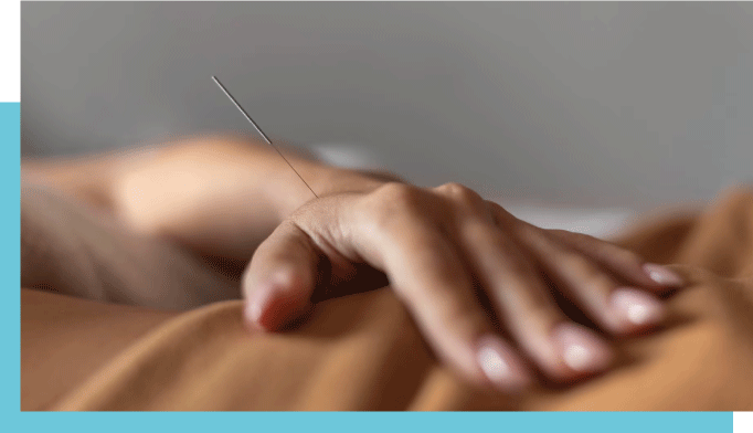 dry-needling-techniques-kine2